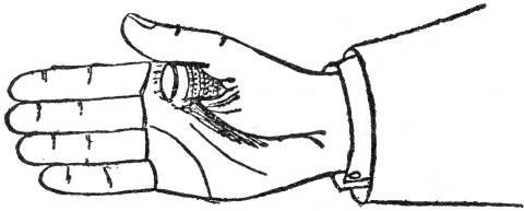 Fig. 25.  Thimble Palmed.